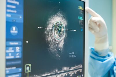 IQVIA Holdings' Q2 2026 Earnings: What to Expect